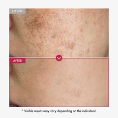 TOSOWOONG Niacinamide serum pink color reflects the nature-driven tint and aesthetics.