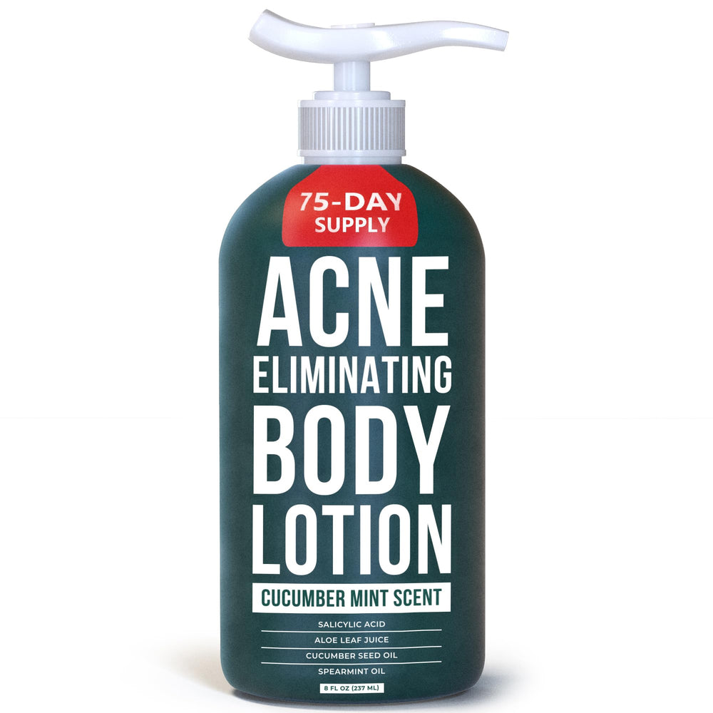 TreeActiv Acne Eliminating Body Lotion bottle with cucumber mint scent for clear, refreshed skin.