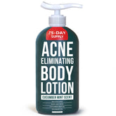 TreeActiv Acne Eliminating Body Lotion bottle with cucumber mint scent for clear, refreshed skin.
