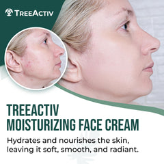 TreeActiv Acne Eliminating Face Cream pump demonstrates mess-free application for daily skincare.