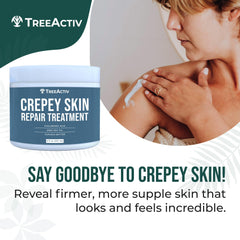 Product packaging of TreeActiv Crepey Skin Repair Cream.