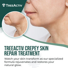 Texture close-up of TreeActiv Crepey Skin Repair Cream smoothing skin.