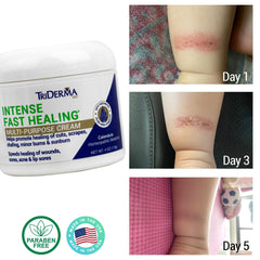 TriDerma Intense Fast Healing Cream hand application demonstrating quick absorption.
