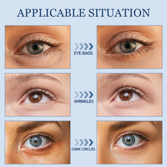 TRIMYFITER eye cream applied around the eyes for refreshed, rested-looking skin.