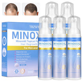 Trzsfr 5% Minoxidil Foam bottle for precise application and potential hair regrowth.
