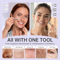 UNOISETION suction probes close-up highlighting effective blackhead removal benefits.