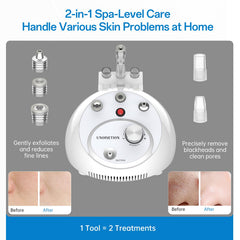 UNOISETION adjustable suction knob up to 80 kPa for tailored care.