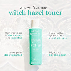 Urban Skin Rx Witch Hazel Toner applied with cotton pads for even complexion.