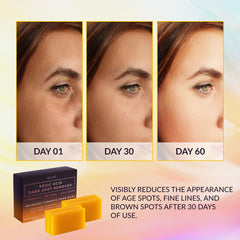 VALITIC Kojic Acid Dark Spot Remover Soap Bar texture close-up highlighting turmeric infusion