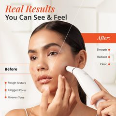 Vanity Planet Exfora manual mode for customized microdermabrasion sessions
