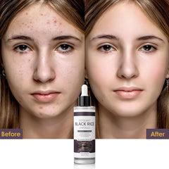 Veakoo Peel Shot Glow ingredient blend with botanicals for antioxidant support
