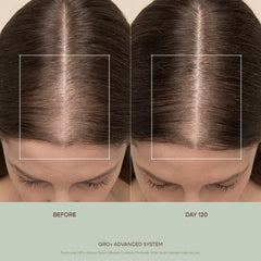 Ingredient panel for GRO+ Balance featuring niacinamide and rosebay leaf.