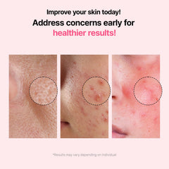 VEGANIFECT Pore Refining Ampoule dropper detail for targeted care