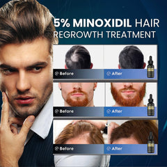 Dropper applying Venanoci serum to scalp for targeted follicle nourishment.