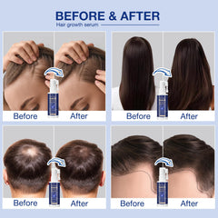 Venanoci rosemary infusion on the scalp suggests circulation support for healthier roots.