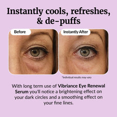 Vibriance Eye Renewal Serum designed for mature skin around the delicate eye area.