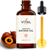 Vital Strands Batana Oil bottle on a clean surface, supporting hair growth.