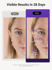VITALY Glow Pro LCD display demonstrates intuitive controls for safe customization
