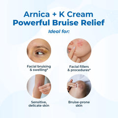 VitaMedica Arnica + Vitamin K bruise cream for under-eye areas eases discoloration with gentle care.