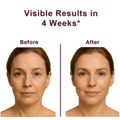 VKSpoa Wrinkle Bounce Balm Stick on nasolabial area for hydration