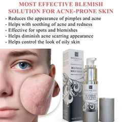 Voibella Beauty blemish spot serum packaging box highlights gentle acne care.