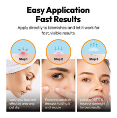 Vonessence patches on skin during day provide discreet blemish care