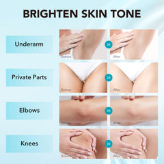 VZP Dark Spot Remover elbows bottle targeting pigmentation with smooth application.