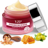 VZP Frankincense Essential Oil Cream packaging highlights premium ingredients for daily moisturization.
