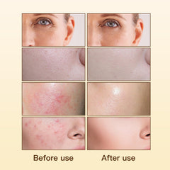 WARMTREE all-natural plant extracts visual conveying calming skin support.