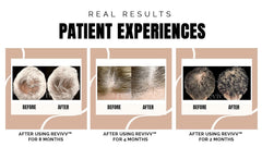 Daily roll-on routine for mess-free, targeted scalp treatment
