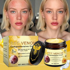 Wlecoso Hands applying Bee Venom Cream demonstrates gentle absorption.