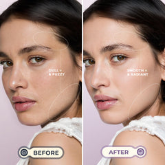 WLU dermaplane tool, purple, sonic movements close-up for smoother skin.