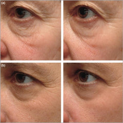 XYJIAXI Instant Firming Eye Serum application on eye area showing smooth, radiant skin.