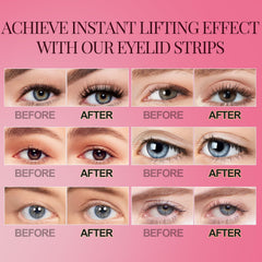 YAGUVI eyelid lift helps with sagging eyelids without surgery.