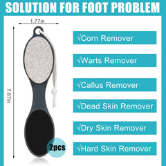 Yclin pumice stone for removing dead skin on feet