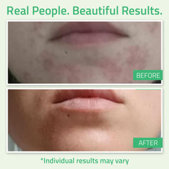 Application scene showing 8-minute leave-on period for refreshed skin
