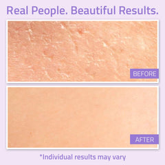 YEOUTH Night cream usage scene demonstrates layering with serums and eye cream.