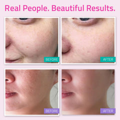 YEOUTH Vitamin C Serum bottle for brightening and even skin tone.