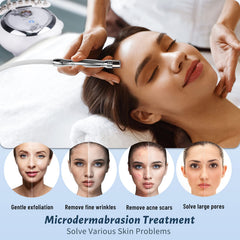Yofuly 68 cmHg suction power for effective pore cleansing