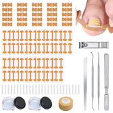 YUVFUDUOV ingrown toenail care kit with breathable strips supports daily comfort