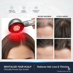 YXYOUNG massager with removable essential oil compartment for aromatherapy massages.