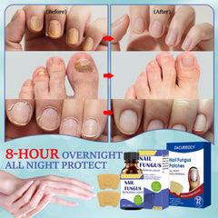 ZACUEEOCY 32-count nail renewal patches for continuous overnight care