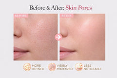 ZAKUTO Hyaluronic acid layer closeup emphasizing deep hydration overnight.