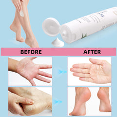 Zegrox Urea Cream 40% foot care application scene showing easy spread.