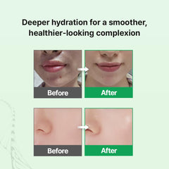 Zipiderm skin barrier action graphic conveys strengthened resilience and moisture retention.