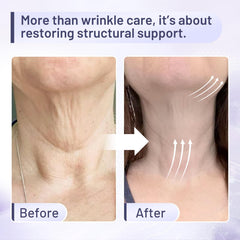 ZZILME Premium Neck Cream being applied to the neck for targeted tightening