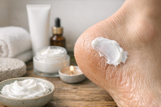 Close-up of moisturizing foot cream applied to cracked heel