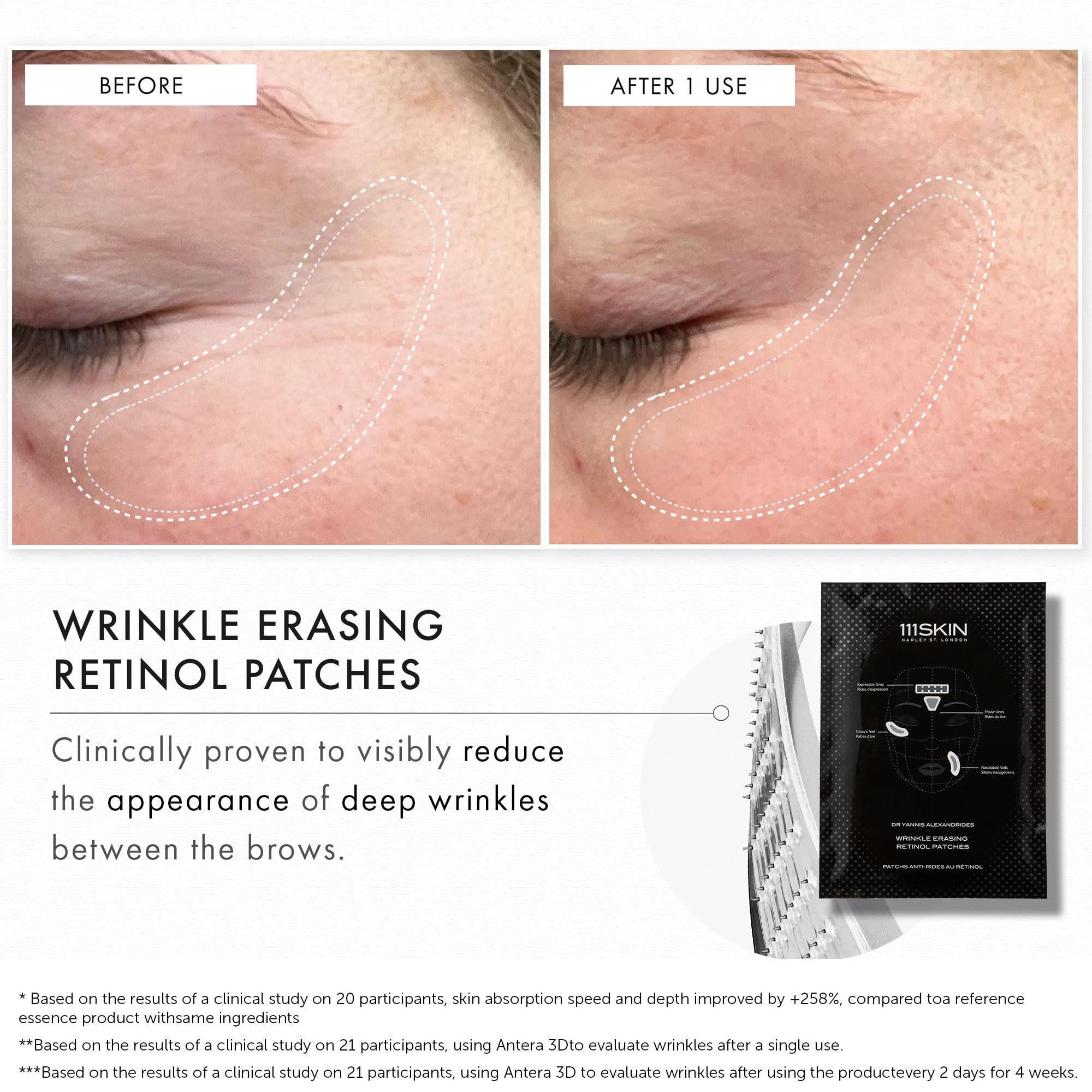 111SKIN patches suit all skin types, including dry and oily