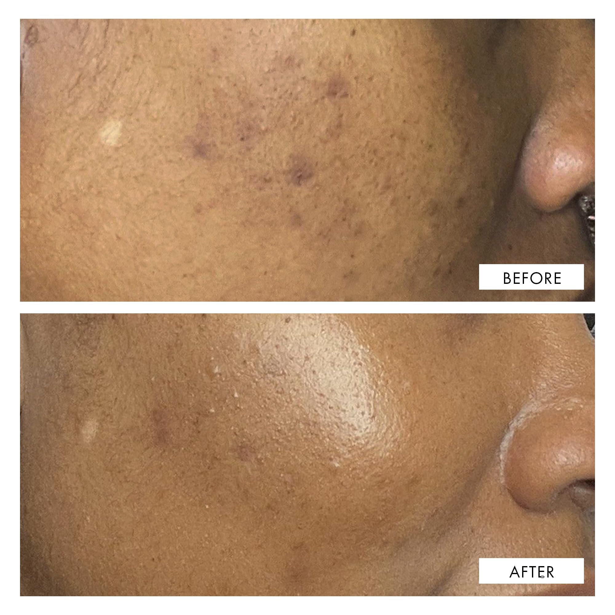 111SKIN luxe packaging box conveying premium care and efficacy