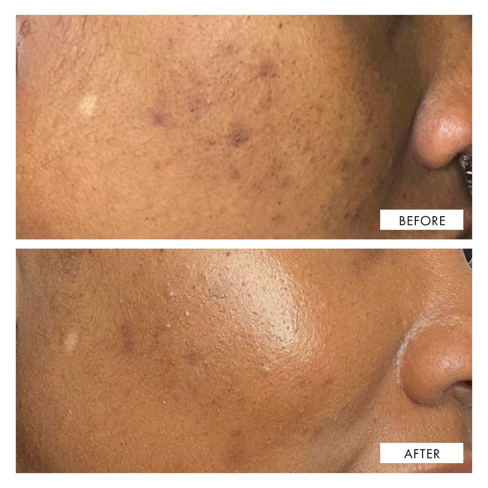 111SKIN luxe packaging box conveying premium care and efficacy
